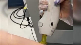 مرکز لیزر پرمون بندرعباس ابرسانی پوست