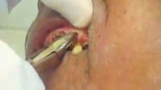 عز الان مس واک بزن ب این روز نیفتی