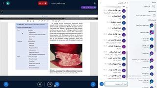 جراحی نظری 2 - دکتر حسن زاده - جلسه 1 پر کردن دندان