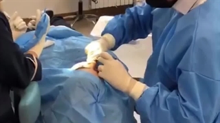 کاشت ایمپلنت با پوشش ریشه ودرمان تحلیل لثه