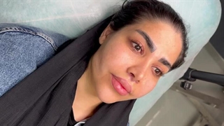 ایفت لب روسی در کلینیک آرتین