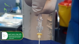 عمل لیزری دیسک کمر. دکتر بهادر محمد امین جراح ستون فقرات کلینیک درد مهرگان