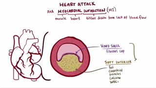 مجموعه فیلم آموزشی قلب و عروق اسموزیس (osmosis)
