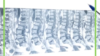 درمان ارتروز کمر. دکتر لیلا بهاری. فوق تخصص درد کلینیک درد مهرگان