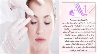 می‌دونی بلفاروپلاستی چقدر می‌تونه زیباترت کنه