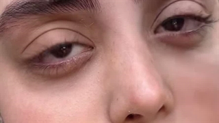 مرکز تخصصی ابرو چشم لب