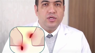 آشنایی با جراحی لیزری هموروئید