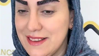 کاشت ابروی طبیعی بدون جراحی در کلینیک زیبایی رنسانس
