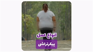 انواع عمل پیکرتراشی